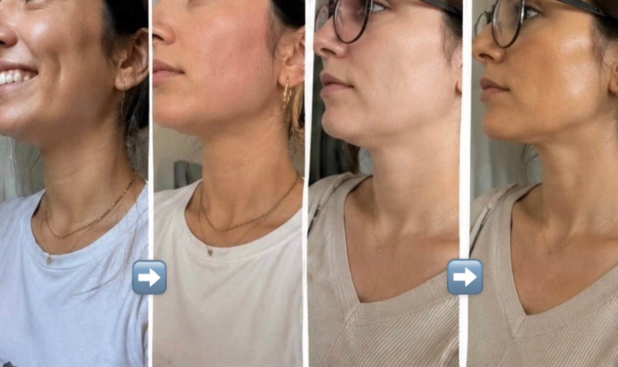 JawLift – Face & Jawline Sculpting Strap