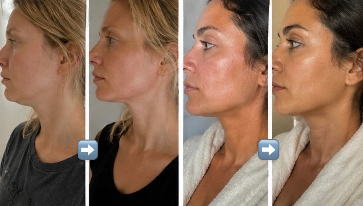 JawLift – Face & Jawline Sculpting Strap