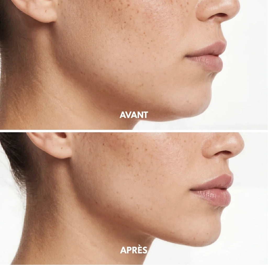 JawLift - La gaine visage sculptante