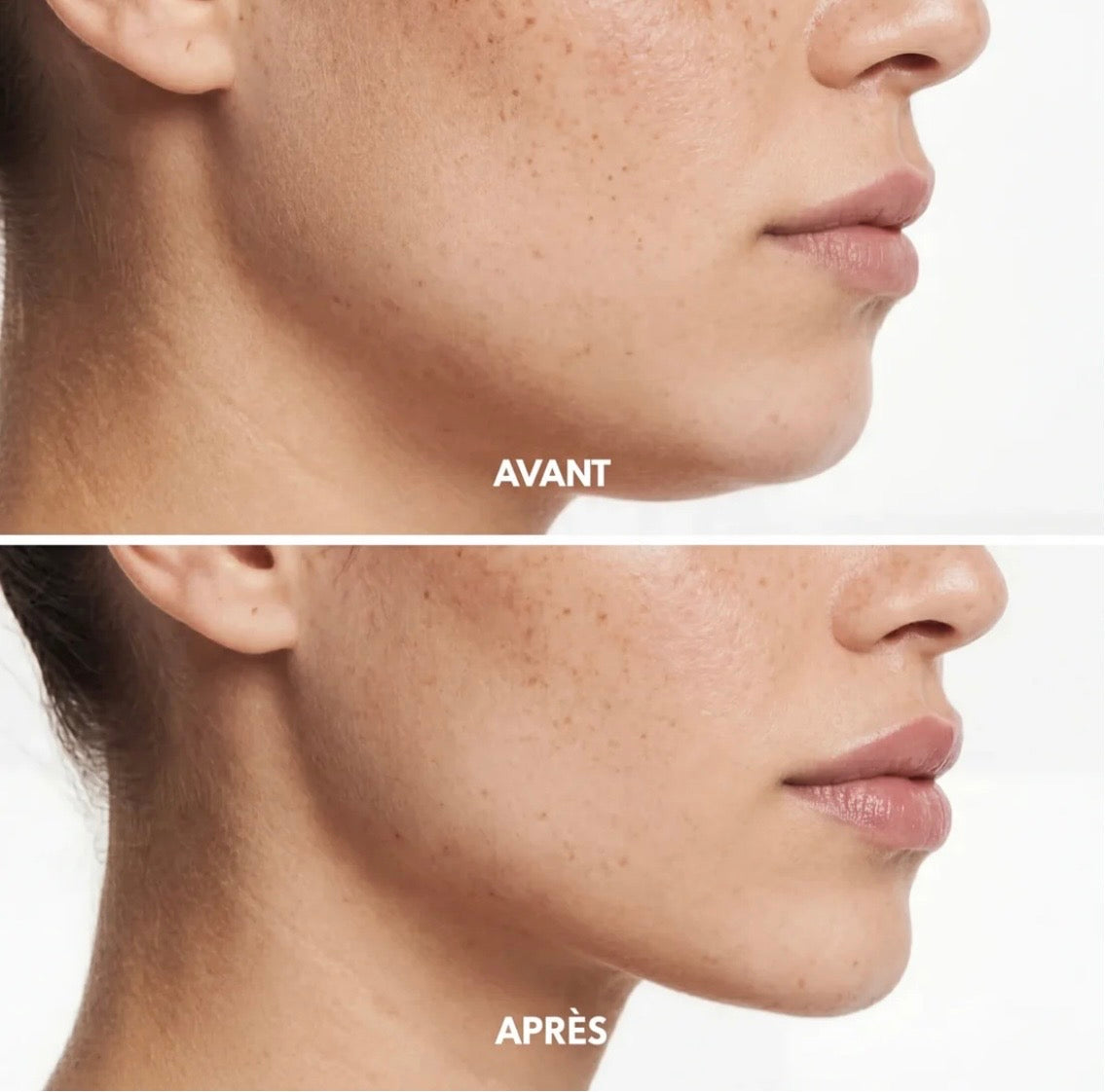 JawLift - La gaine visage sculptante